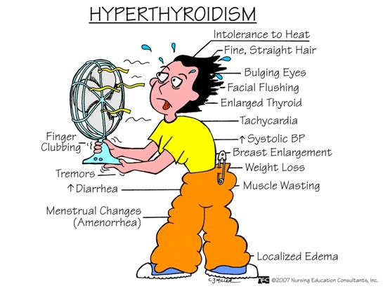 Hyperthroidism